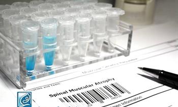 بیماری آتروفی عضلانی نخاعی SMA و برنامه ملی غربالگری